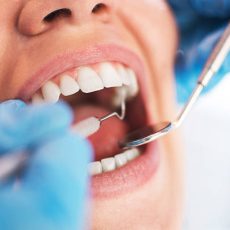 Open female mouth during oral checkup at the dentist. Selective focus. Open female mouth during oral checkup at the dentist. Selective focus.